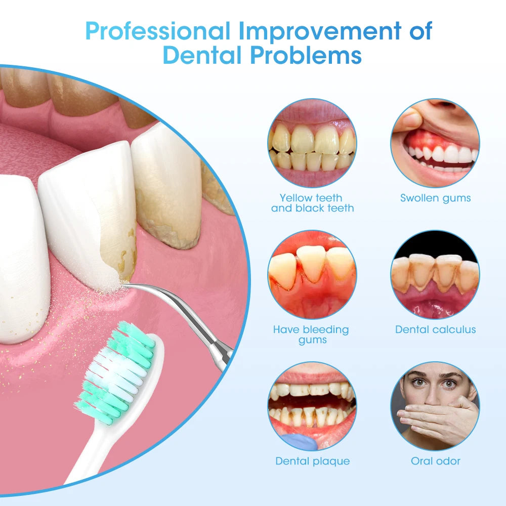 SonicSmile - Professionele reiniging voor een stralende glimlach